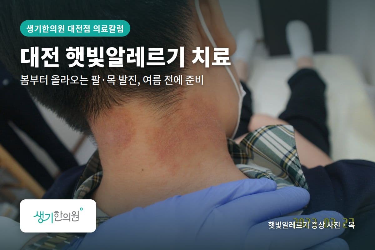 목 햇빛알레르기 증상 사진과 문구 「대전 햇빛알레르기 치료, 봄부터 올라오는 팔·목 발진, 여름 전에 준비 · 생기한의원 대전점」